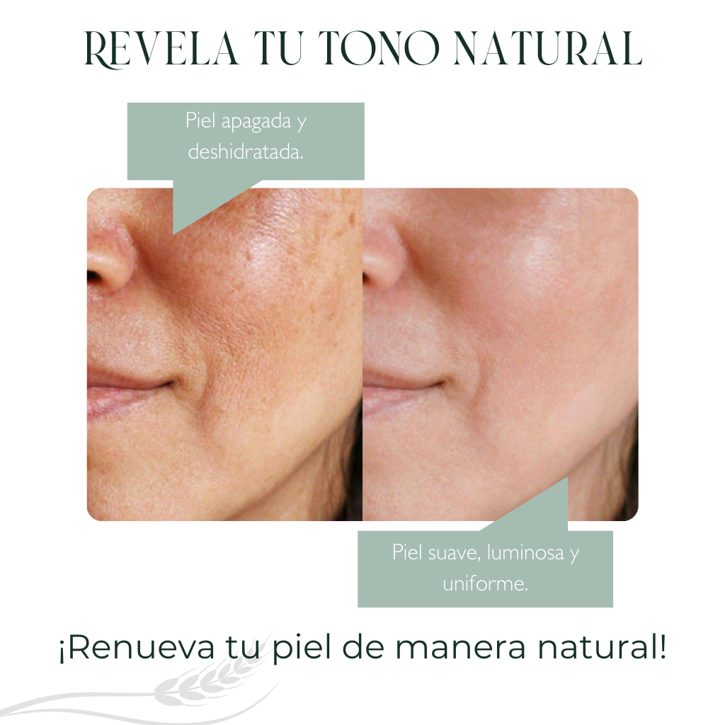 Kit Aclarante Intensivo – Rutina completa para piel con manchas